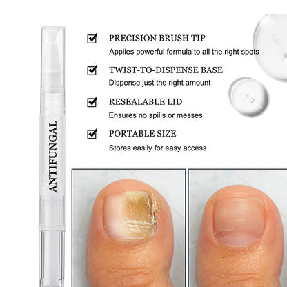 Toenail Fungus Treatment Pen for Damaged Nails 💅Easily Achieve Glossy Nails