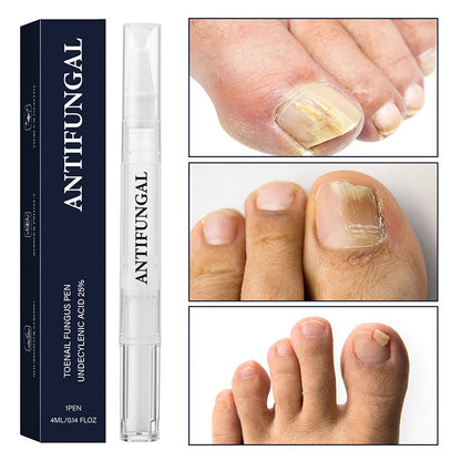Toenail Fungus Treatment Pen for Damaged Nails 💅Easily Achieve Glossy Nails