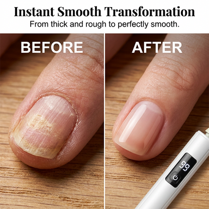 🔧Professional Electric Nail Polisher - Salon‑quality Nails At Home💅✨